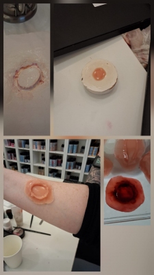 Refaire une plaie à chaque exercice ? Et si c’était terminé…